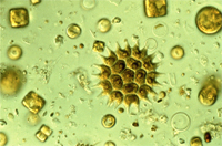 Phytoplankton (Foto: Jürgen Bäthe)